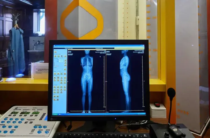 Echelon Health 5